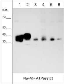 Western Blot: ATPase Na+/K+ beta 3 Antibody (M025) [NBP3-23434] - Western blot of native human MDA-MB-231 (lane 1), and MeWo (lane 2) cell lysates, as well as native human breast (lane 3), lung (lane 4), skin (lane 5), and brain (lane 6) tissues. The blot was probed with anti-ATPase Na+/K+ beta 3 (NBP3-23434) at 1:1000.