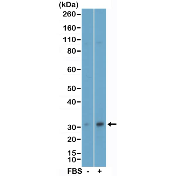Western Blot: eIF4E Antibody (RM452) [NBP3-23456] - Western Blot of the lysates of MCF-7 cells nontreated (-) or treated (+) with fetal bovine serum, using Clone RM452 at a 1:1000 dilution.