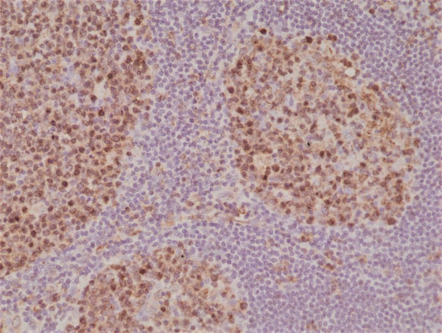 Immunohistochemistry-Paraffin: Stathmin 1 Antibody (RM350) [NBP3-23457] - Immunohistochemical staining of formalin fixed and paraffin embedded human Tonsil tissue section using Clone RM350) at a 1:1000 dilution.