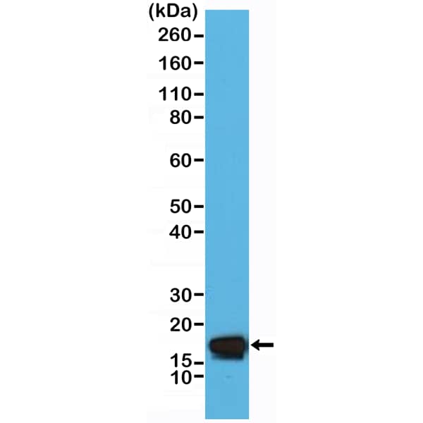 Western Blot: Stathmin 1 Antibody (RM350) [NBP3-23457] - Western Blot of HeLa cell lysate using Clone RM350) at a 1:5000 dilution.