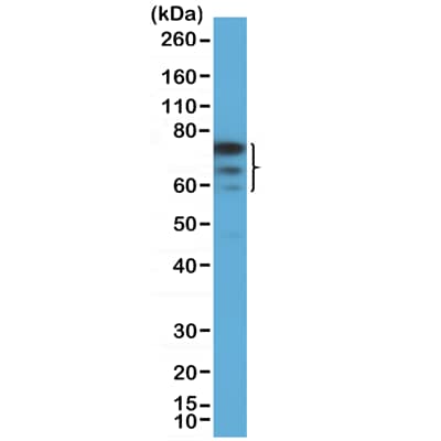 Western Blot: FoxP1 Antibody (RM402) [NBP3-23460] - Western Blot of 293 cell lysate using Clone RM402) at a 1:1000 dilution.