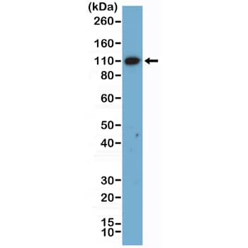 Western Blot: MSH2 Antibody (RM478) [NBP3-23464] - Western Blot of HeLa lysate using Clone RM478) at a 1:5000 dilution.