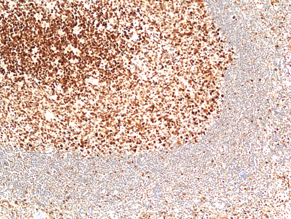 Immunohistochemistry-Paraffin: MSH2 Antibody (RM478) [NBP3-23464] - Immunohistochemical staining of formalin fixed and paraffin embedded human tonsil tissue section using Clone RM478) at a 1:100 dilution.