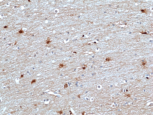 Immunohistochemistry-Paraffin: ERK2 Antibody (RM483) [NBP3-23465] - Immunohistochemical staining of formalin fixed and paraffin embedded human Brain tissue sections using Clone RM483) at 1:100 dilution.