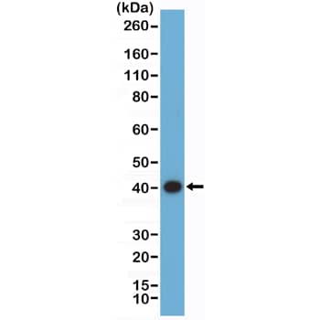 Western Blot: ERK2 Antibody (RM483) [NBP3-23465] - Western Blot of 293 cell lysate using Clone RM483) at 1:2000 dilution.