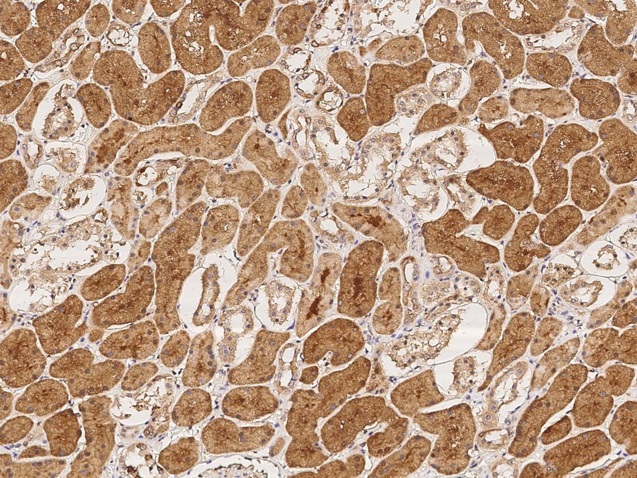 Immunohistochemistry-Paraffin: L3HYPDH Antibody [NBP3-23479] - Immunochemical staining of human L3HYPDH in human kidney with NBP3-23479 at 1:100 dilution, formalin-fixed paraffin embedded sections.