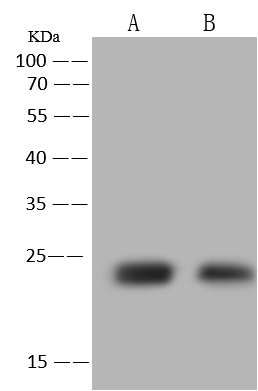 Western Blot: TTC36 Antibody [NBP3-23480] - NBP3-23480 at 1:500 dilution. Lane A: Mouse Liver tissue Lysate. Lane B: Rat Liver tissue Lysate. Lysates/proteins at 30 ug per lane. Secondary Goat Anti-Rabbit IgG (H+L) [HRP] at 1/10000 dilution. Developed using the ECL technique. Performed under reducing conditions. Predicted band size: 20 kDa. Observed band size: 24 kDa