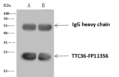 Immunoprecipitation: TTC36 Antibody - BSA Free [NBP3-23480] - TTC36-FP11356 was immunoprecipitated using: Lane A:0.5 mg Mouse liver Whole Cell Lysate Lane B:0.5 mg Rat liver Whole Cell Lysate 4 uL NBP3-23480 and 60 ug of Immunomagnetic beads Protein A/G. Primary antibody: NBP3-23480, at 1:100 dilution. Secondary antibody: Goat Anti-Rabbit IgG (H+L) [HRP] at 1/10000 dilution. Developed using the ECL technique. Performed under reducing conditions. Predicted band size: 20 kDa Observed band size :20 kDa 