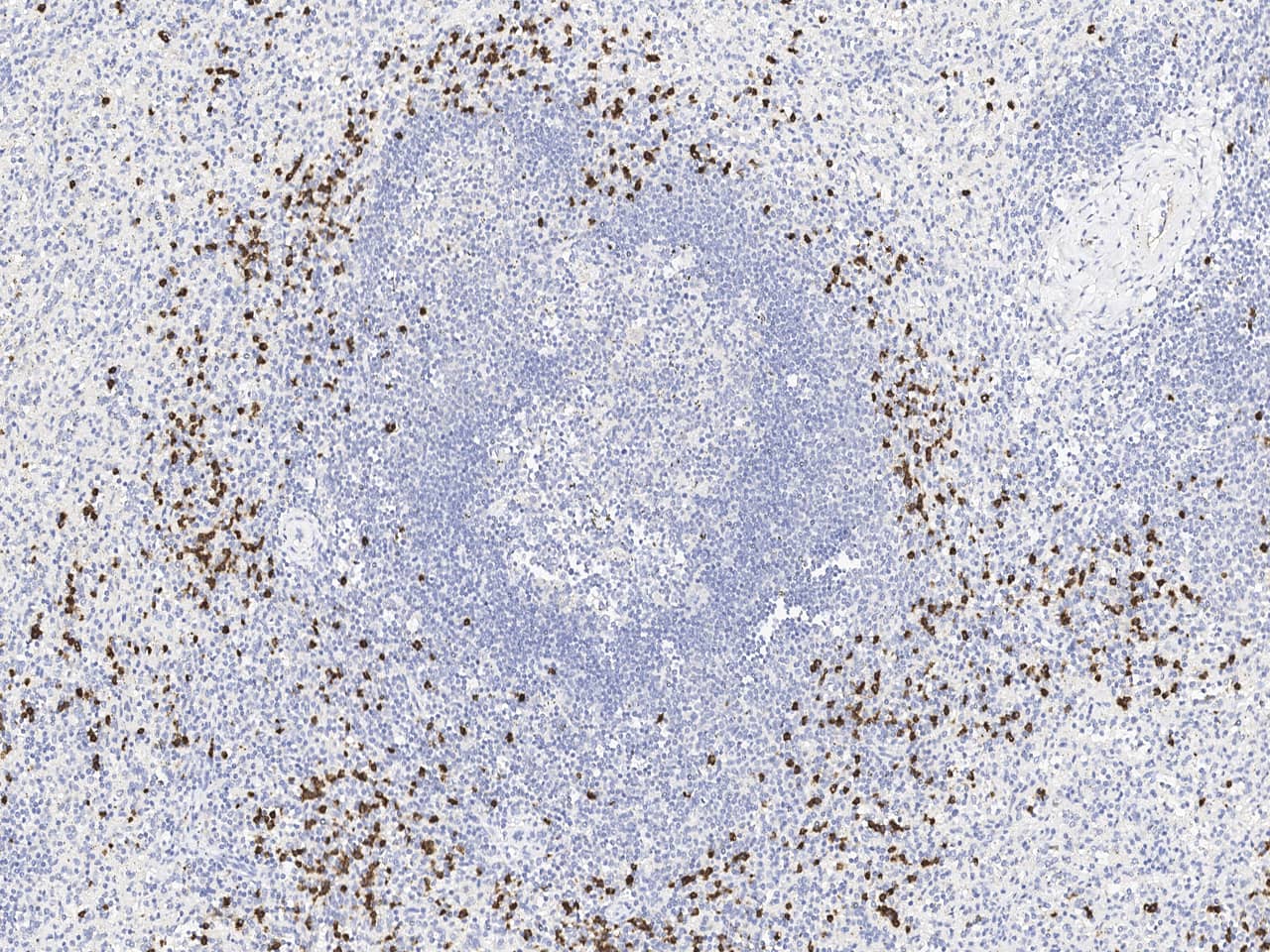 Immunohistochemistry-Paraffin: Lipocalin-2/NGAL Antibody (508) [NBP3-23485] - Immunochemical staining of human Lipocalin-2/NGAL in human spleen with NBP3-23485 at 1:1000 dilution, formalin-fixed paraffin embedded sections.