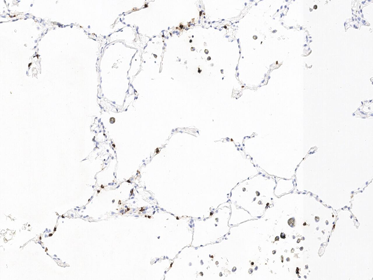 Immunohistochemistry-Paraffin: Lipocalin-2/NGAL Antibody (508) [NBP3-23485] - Immunochemical staining of human Lipocalin-2/NGAL in human lung with NBP3-23485 at 1:1000 dilution, formalin-fixed paraffin embedded sections.