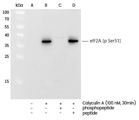 Western Blot: eIF2A [p Ser51] Antibody (0011) [NBP3-23508] - Western blot analysis of extracts from serum-starved Hela, untreated (line A); treated with Calyculin A (100nM, 30 min), without peptide (line B) or antigen-specific phosphopeptide (line C) or antigen-specific peptide (line D) using NBP3-23508 at 1:1000 dilution.