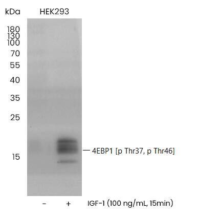 Western Blot: 4EBP1 [p Thr37, p Thr46] Antibody (0014) - Azide and BSA Free [NBP3-23518] - Western blot analysis of extracts from serum-starved HEK293, untreated (-) or treated with IGF-1 (100 ng/mL, 15min) using NBP3-23518 at 1:1000 dilution.