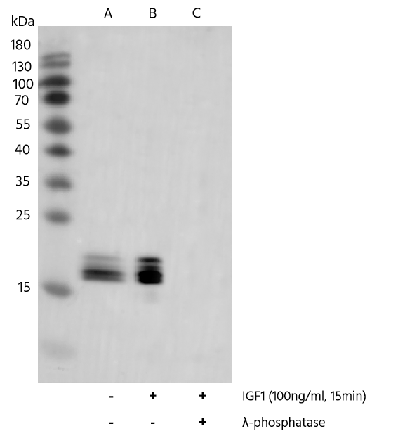 Western Blot: 4EBP1 [p Thr46, p Thr37] Antibody (0014) [NBP3-23518] - Western blot analysis of extracts from serum-starved HEK293, untreated (line A); treated with IGF1 (100ng/ml, 15min;+) (line B); treated with IGF1 and -phosphatase (line C) using NBP3-23518 at 1:5000 dilution. 