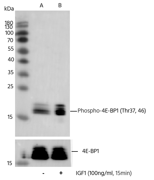 Western Blot: 4EBP1 [p Thr46, p Thr37] Antibody (0014) [NBP3-23518] - Western blot analysis of extracts from HEK293, untreated(line A) or treated with IGF1 (100ng/ml, 15min; +)(line B), using NBP3-23518 at 1:5000 dilution (upper) or Mouse Monoclonal 4EBP1 Antibody at 1:5000 dilution (lower).
