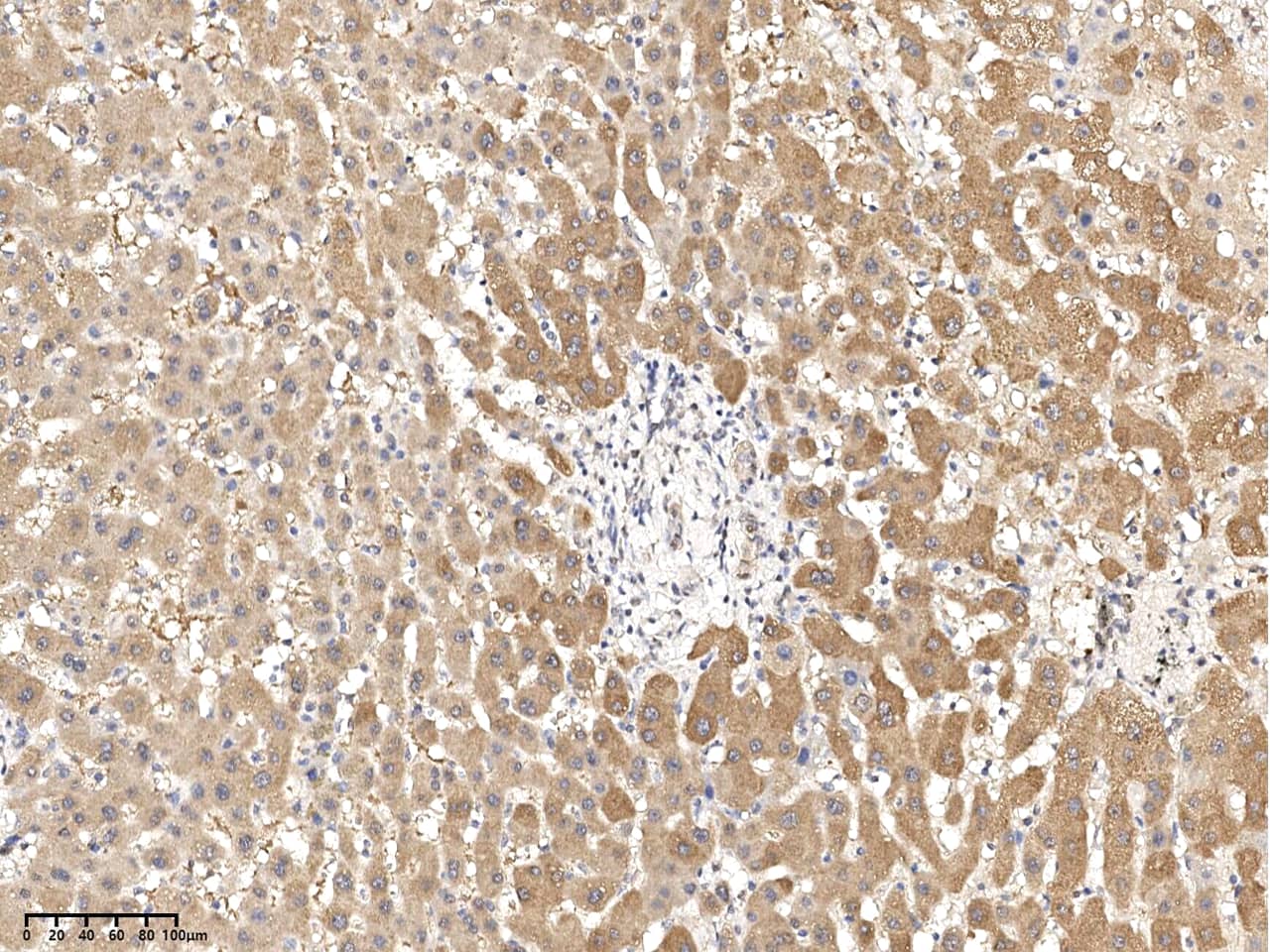 Immunohistochemistry-Paraffin: RNF114 Antibody - Azide and BSA Free [NBP3-23520] - Immunochemical staining of human RNF114 in human liver with NBP3-23520 at 1:500 dilution, formalin-fixed paraffin embedded sections.