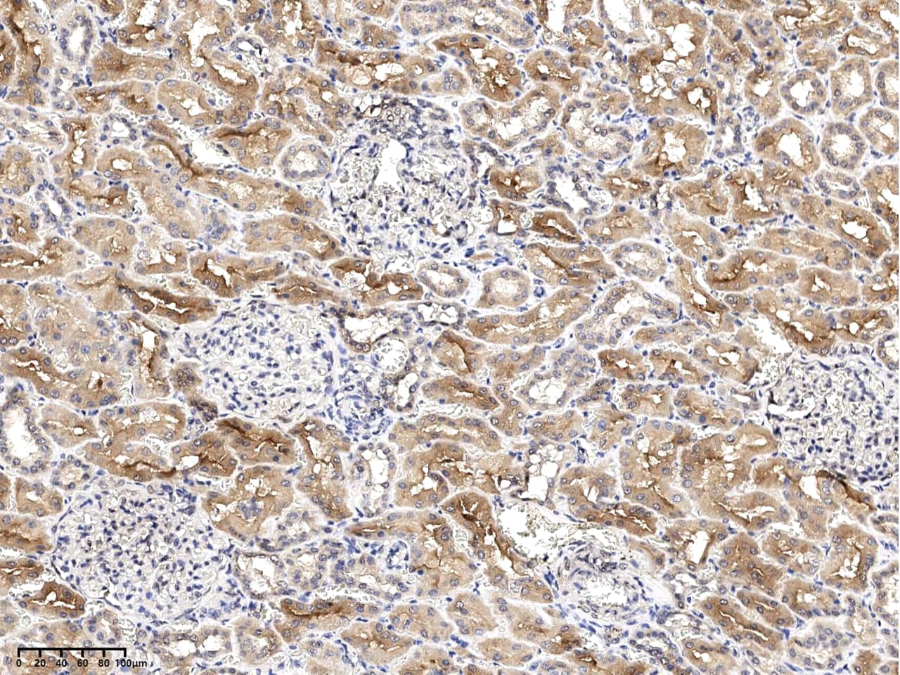 Immunohistochemistry-Paraffin: RNF114 Antibody - Azide and BSA Free [NBP3-23520] - Immunochemical staining of human RNF114 in human kidney with NBP3-23520 at 1:500 dilution, formalin-fixed paraffin embedded sections.