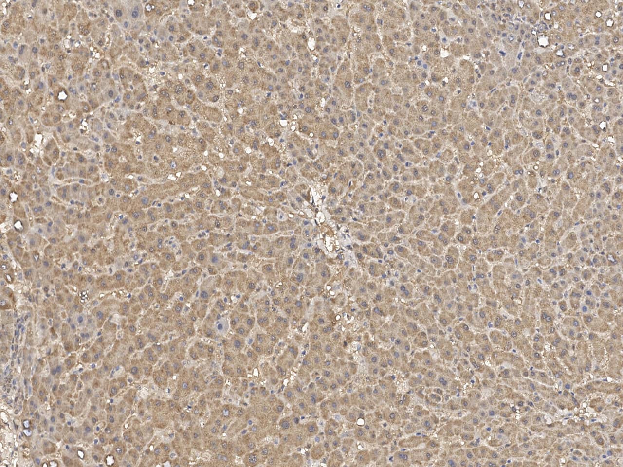 Immunohistochemistry-Paraffin: Jade-1/PHF17 Antibody - Azide and BSA Free [NBP3-23522] - Immunochemical staining of human Jade-1/PHF17 in human liver with NBP3-23522 at 1:100 dilution, formalin-fixed paraffin embedded sections.
