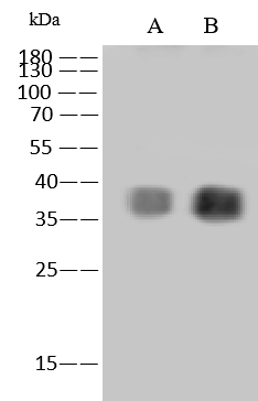 Western Blot: Monkeypox Virus B6R Antibody (006) - Azide and BSA Free [NBP3-23526] - NBP3-23526 at 1:1000 dilution. Lane A: Monkeypox Virus B6R Protein 10ng. Lane B: Vaccinia virus (VACV) (strain Copenhagen) Protein B5 10ng. Secondary Goat Anti-Rabbit IgG (H+L) [HRP] at 1/10000 dilution. Developed using the ECL technique. Performed under reducing conditions.