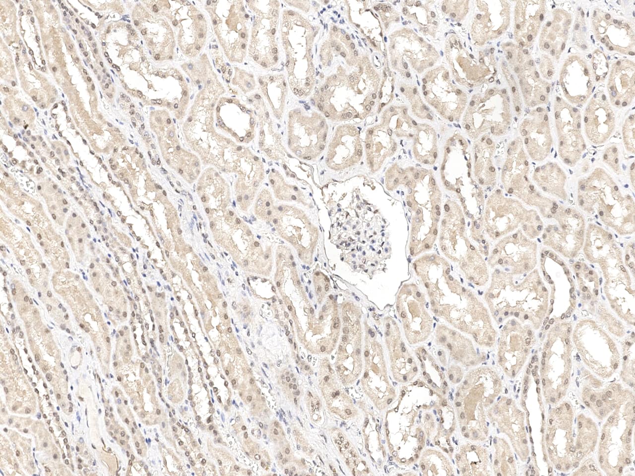 Immunohistochemistry-Paraffin: GTF3C6 Antibody - Azide and BSA Free [NBP3-23528] - Immunochemical staining of human GTF3C6 in human kidney with NBP3-23528 at 1:100 dilution, formalin-fixed paraffin embedded sections.