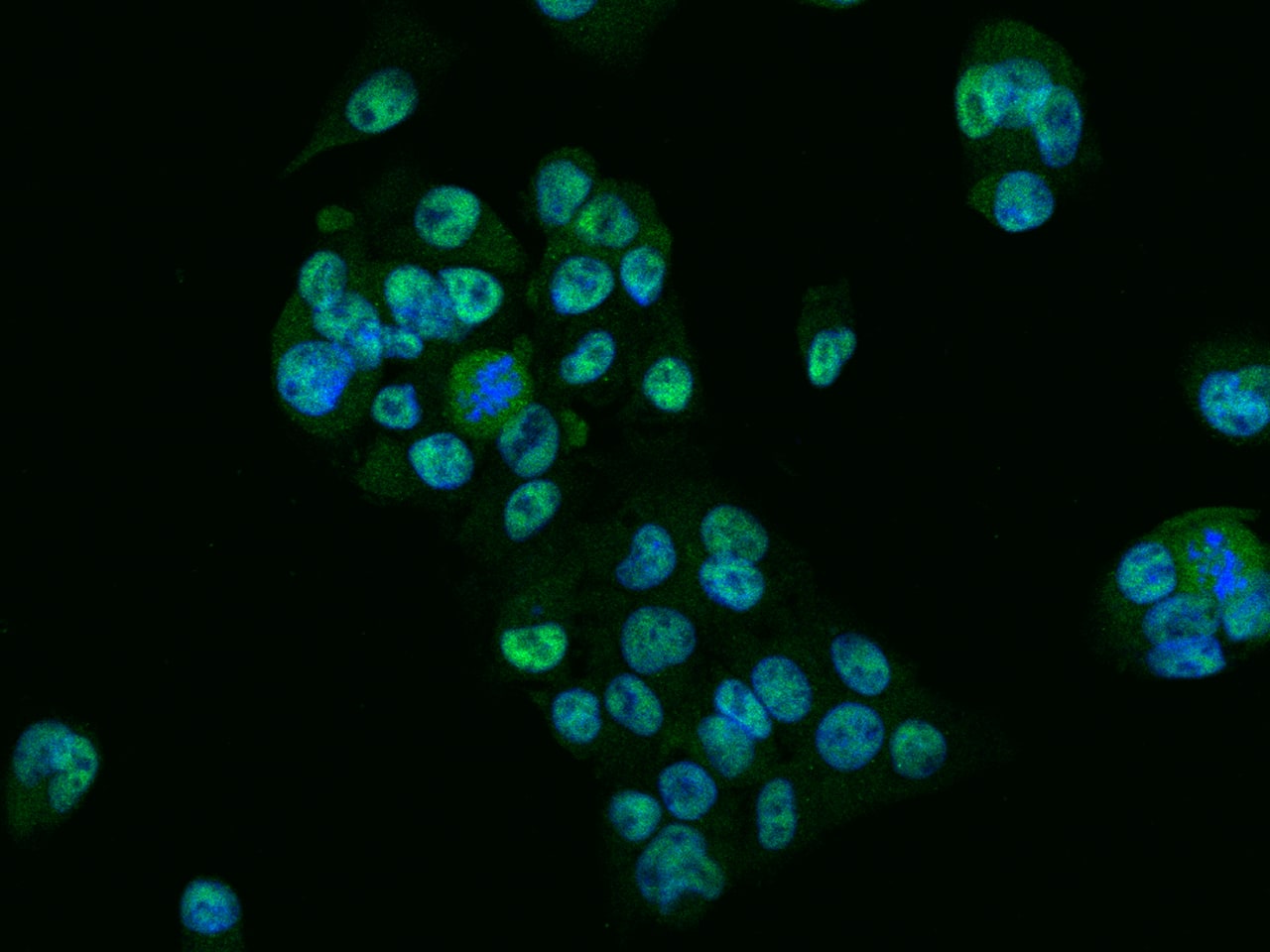Immunocytochemistry/ Immunofluorescence: GTF3C6 Antibody [NBP3-23528] - Immunofluorescence staining of GTF3C6 in HepG2 cells. Cells were fixed with 4% PFA, permeabilzed with 0.3% Triton X-100 in PBS, blocked with 10% serum, and incubated with NBP3-23528 (dilution ratio 1:100) at 4C overnight. Then cells were stained with the Goat Anti-rabbit IgG secondary antibody [Alexa Fluor 488] (green) and counterstained with DAPI (blue). Positive staining was localized to Nucleus.