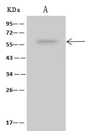 Immunoprecipitation: dynactin 4 Antibody - Azide and BSA Free [NBP3-23532] - dynactin 4 was immunoprecipitated using: Lane A:0.5 mg Jurkat Whole Cell Lysate 4 µL NBP3-23532 and 60 ug of Immunomagnetic beads Protein A/G. Primary antibody: NBP3-23532,at 1:100 dilution Secondary antibody: Clean-Blot IP Detection Reagent (HRP) at 1:1000dilution Developed using the ECL technique. Performed under reducing conditions. Predicted band size: 52 kDa Observed band size :57 kDa