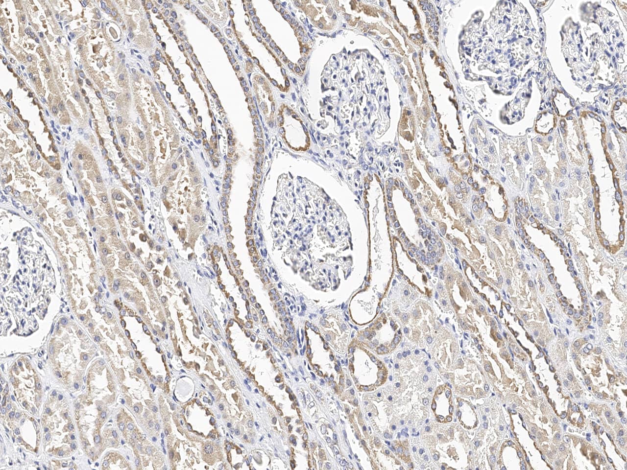 Immunohistochemistry-Paraffin: MGME1 Antibody - Azide and BSA Free [NBP3-23534] - Immunochemical staining of human MGME1 in human kidney with NBP3-23534 at 1:100 dilution, formalin-fixed paraffin embedded sections.