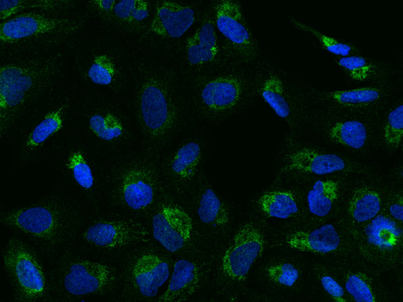 Immunocytochemistry/ Immunofluorescence: MGME1 Antibody [NBP3-23534] - Immunofluorescence staining of MGME1 in U2OS cells. Cells were fixed with 4% PFA, permeabilzed with 0.3% Triton X-100 in PBS, blocked with 10% serum, and incubated with NBP3-23534 (dilution ratio 1:100) at 4C overnight. Then cells were stained with the Goat Anti-rabbit IgG secondary antibody [Alexa Fluor 488] (green) and counterstained with DAPI (blue). Positive staining was localized to Cytoplasm.
