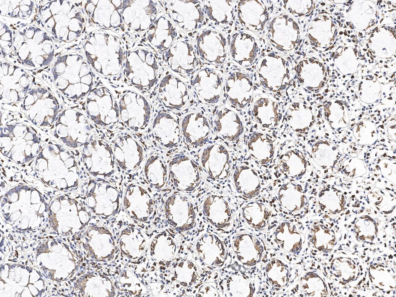 Immunohistochemistry-Paraffin: MGME1 Antibody [NBP3-23534] - Immunochemical staining of human MGME1 in human rectum with NBP3-23534 at 1:100 dilution, formalin-fixed paraffin embedded sections.