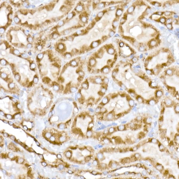 Immunohistochemistry: Tubulin alpha-1B Antibody (ARC51243) [NBP3-23538] - Immunohistochemistry analysis of paraffin-embedded Human tonsil tissue using Tubulin alpha-1B Rabbit mAb at a dilution of 1:200 (40x lens). High pressure antigen retrieval performed with 0.01M Citrate Bufferr (pH 6.0) prior to IHC staining.