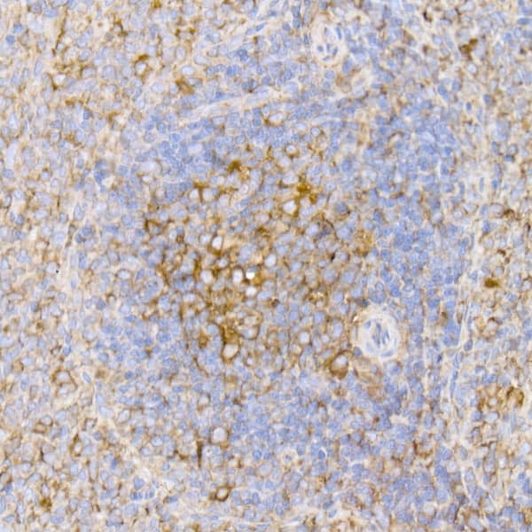 Immunohistochemistry: Tubulin alpha-1B Antibody (ARC51243) [NBP3-23538] - Immunohistochemistry analysis of paraffin-embedded Mouse kidney tissue using Tubulin alpha-1B Rabbit mAb at a dilution of 1:200 (40x lens). High pressure antigen retrieval performed with 0.01M Citrate Bufferr (pH 6.0) prior to IHC staining.