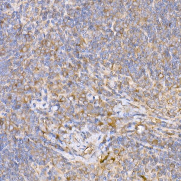 Immunohistochemistry Tubulin alpha-1B Antibody (ARC51243)