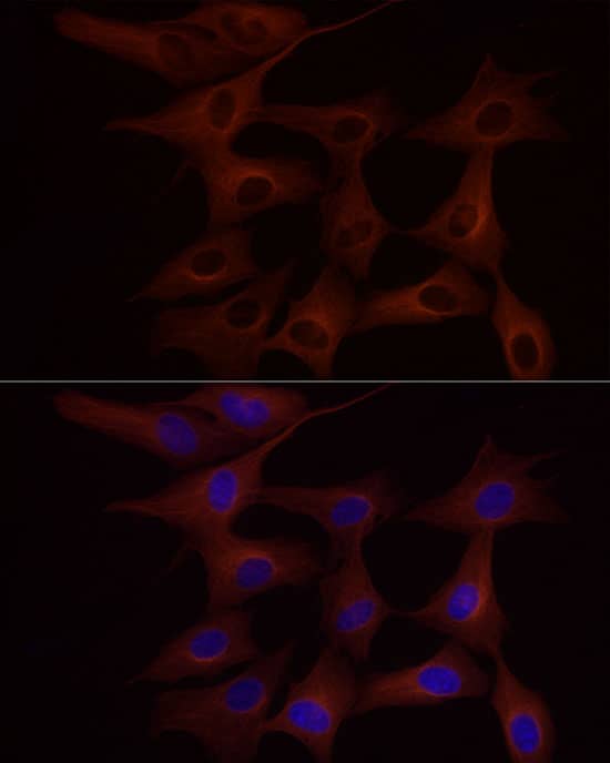 Immunohistochemistry: Tubulin alpha-1B Antibody (ARC51243) [NBP3-23538] - Immunohistochemistry analysis of paraffin-embedded Rat colon tissue using Tubulin alpha-1B Rabbit mAb at a dilution of 1:200 (40x lens). High pressure antigen retrieval performed with 0.01M Citrate Bufferr (pH 6.0) prior to IHC staining.