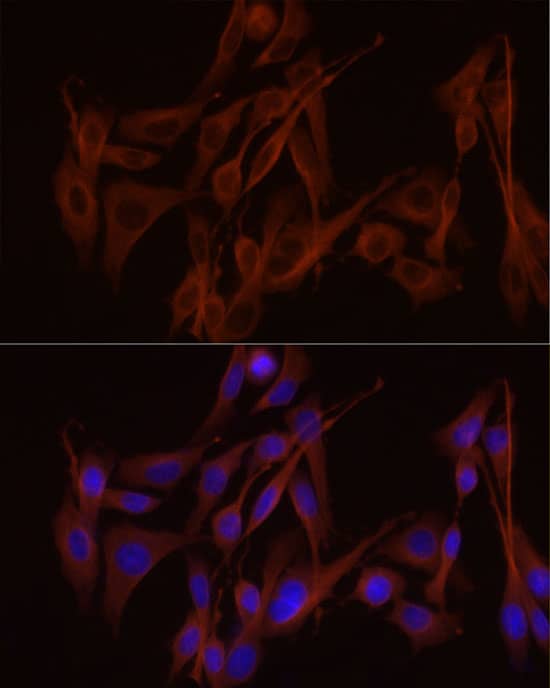 Immunocytochemistry/ Immunofluorescence: Tubulin alpha-1B Antibody (ARC51243) [NBP3-23538] - Confocal imaging of HeLa cells using  alpha -Tubulin Rabbit mAb(Green). The cells were counterstained with RAB11A Rabbit mAb. DAPI was used for nuclear staining (blue). Objective: 60x.