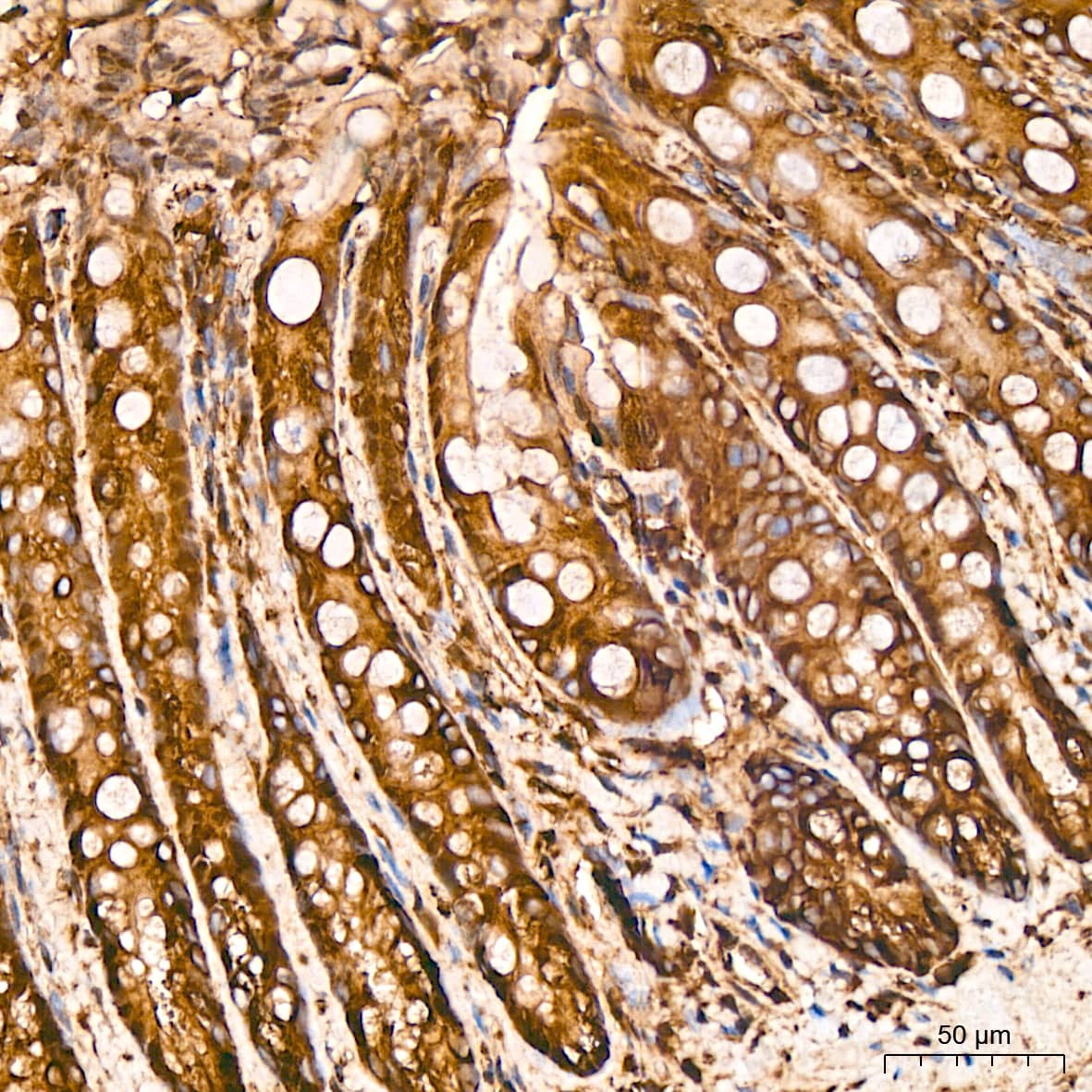 Immunohistochemistry: Tubulin alpha-1B Antibody  [NBP3-23538] - Immunohistochemistry analysis of Tubulin alpha-1B in paraffin-embedded rat colon tissue using Tubulin alpha-1B Rabbit mAb  at a dilution of 1:200 (40x lens).High pressure antigen retrieval was performed with 0.01 M citrate buffer (pH 6.0) prior to IHC staining.