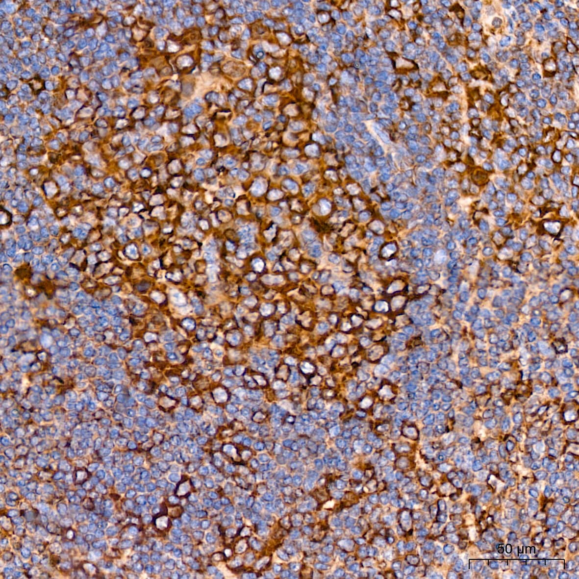 Immunohistochemistry: Tubulin alpha-1B Antibody  [NBP3-23538] - Immunohistochemistry analysis of Tubulin alpha-1B in paraffin-embedded human tonsil tissue using Tubulin alpha-1B Rabbit mAb  at a dilution of 1:200 (40x lens).High pressure antigen retrieval was performed with 0.01 M citrate buffer (pH 6.0) prior to IHC staining.