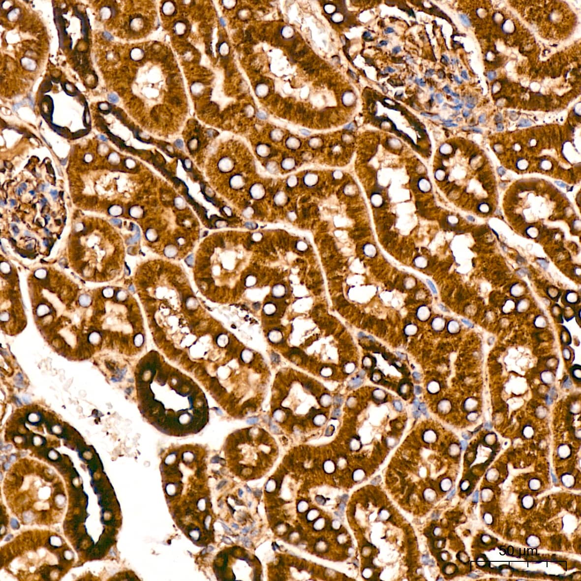 Immunohistochemistry: Tubulin alpha-1B Antibody  [NBP3-23538] - Immunohistochemistry analysis of Tubulin alpha-1B in paraffin-embedded mouse kidney tissue using Tubulin alpha-1B Rabbit mAb  at a dilution of 1:200 (40x lens).High pressure antigen retrieval was performed with 0.01 M citrate buffer (pH 6.0) prior to IHC staining.