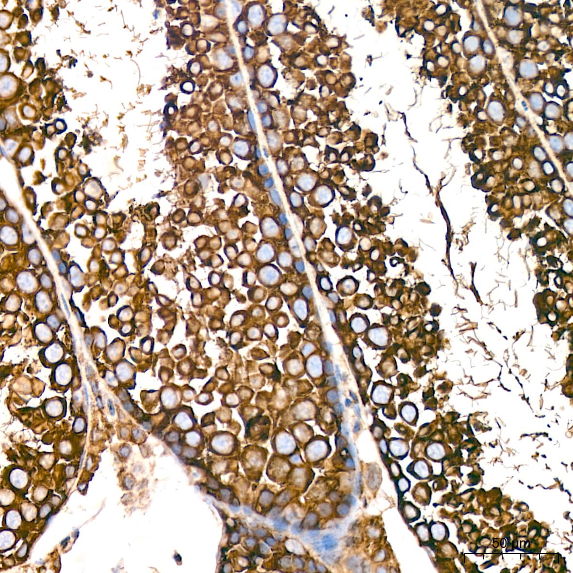 Immunohistochemistry: Tubulin alpha-1B Antibody  [NBP3-23538] - Immunohistochemistry analysis of Tubulin alpha-1B in paraffin-embedded mouse testis tissue using Tubulin alpha-1B Rabbit mAb  at a dilution of 1:200 (40x lens).High pressure antigen retrieval was performed with 0.01 M citrate buffer (pH 6.0) prior to IHC staining.