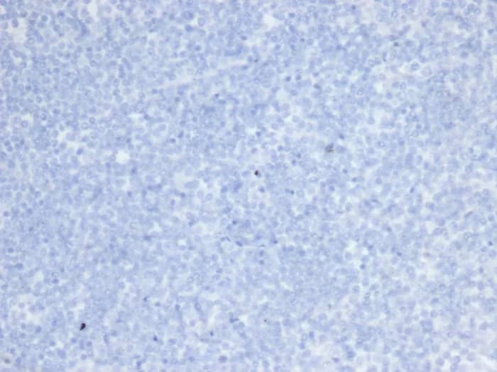 Immunohistochemistry-Paraffin: ErbB2/Her2 Antibody (rERBB2/6637) [NBP3-23581] - IHC analysis of formalin-fixed, paraffin-embedded human brain. Negative tissue control using ErbB2/Her2 Antibody (rERBB2/6637) at 2ug/ml in PBS for 30min RT. HIER: Tris/EDTA, pH9.0, 45min. 2°C: HRP-polymer, 30min. DAB, 5min.