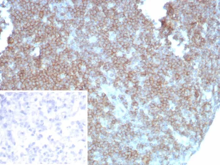 Immunohistochemistry-Paraffin: CD27/TNFRSF7 Antibody (LPFS2/8838R) [NBP3-23582] - Formalin-fixed, paraffin-embedded human lymph node stained with CD27/TNFRSF7 Antibody (LPFS2/8838R). Inset: PBS instead of primary antibody; secondary only negative control.
