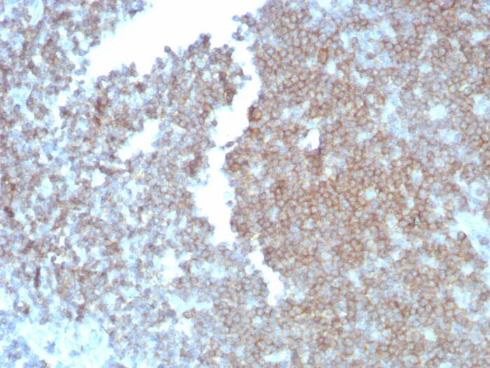 Immunohistochemistry-Paraffin: CD27/TNFRSF7 Antibody (LPFS2/8838R) [NBP3-23582] - Formalin-fixed, paraffin-embedded human lymph node stained with CD27/TNFRSF7 Antibody (LPFS2/8838R). HIER: Tris/EDTA, pH9.0, 45min. 2°C: HRP-polymer, 30min. DAB, 5min.