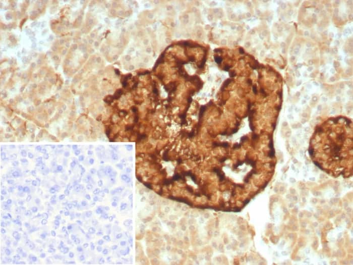 Immunohistochemistry-Paraffin: Chromogranin A Antibody (CHGA/8929R) [NBP3-23592] - Formalin-fixed, paraffin-embedded human pancreas stained with Chromogranin A Antibody (CHGA/8929R). HIER: Tris/EDTA, pH9.0, 45min. 2°C: HRP-polymer, 30min. DAB, 5min.
