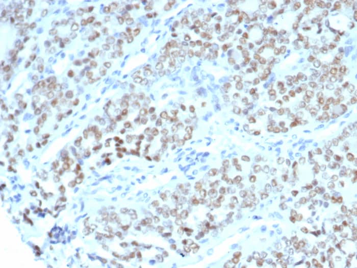 Formalin-fixed, paraffin-embedded human fallopian tube stained with BTBD9 antibody (BTBD9/7501). HIER: Tris/EDTA, pH9.0, 45min. Secondary: HRP-polymer, 30min. DAB, 5min.