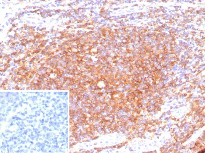 Immunohistochemistry-Paraffin: CD40/TNFRSF5 Antibody (C40/9225R) [NBP3-23606] - Formalin-fixed, paraffin-embedded human tonsil stained with CD40/TNFRSF5 Antibody (C40/9225R). Inset: PBS instead of primary antibody; secondary only negative control.