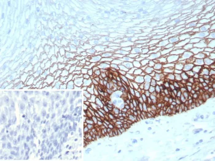 Immunohistochemistry-Paraffin: CD44 Antibody (CD44V6/9400R) [NBP3-23607] - Formalin-fixed, paraffin-embedded human esophagus stained with CD44 Antibody (CD44V6/9400R). Inset: PBS instead of primary antibody; secondary only negative control.