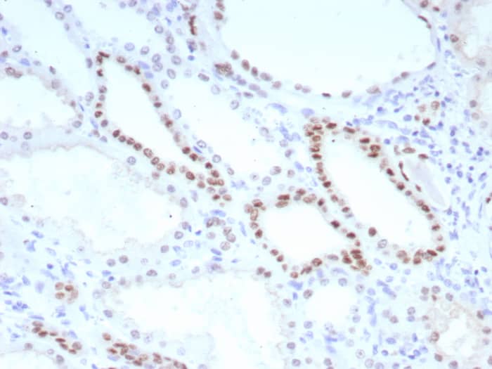 Formalin-fixed, paraffin-embedded human kidney stained with PAX8 antibody (PAX8/8651R). HIER: Tris/EDTA, pH9.0, 45min. Secondary: HRP-polymer, 30min. DAB, 5min.