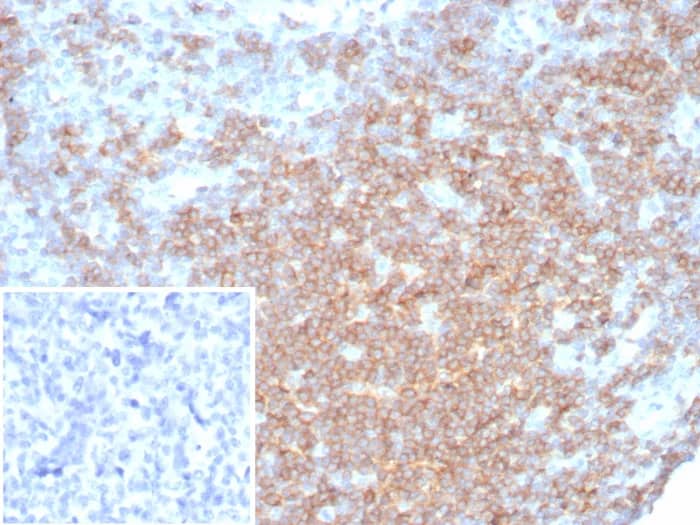 Immunohistochemistry-Paraffin: CD27/TNFRSF7 Antibody (LPFS2/8316R) [NBP3-23618] - Formalin-fixed, paraffin-embedded human lymph node stained with CD27/TNFRSF7 Antibody (LPFS2/8316R). Inset: PBS instead of primary antibody; secondary only negative control.