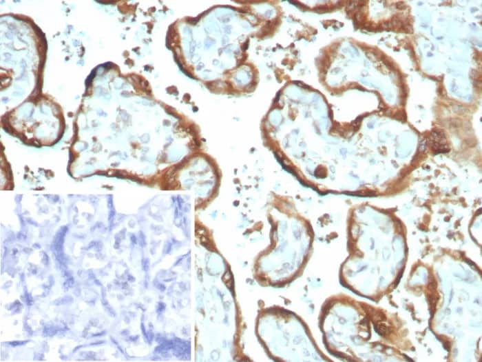 Immunohistochemistry-Paraffin: IMP3 Antibody (IMP3/8934R) [NBP3-23624] - Formalin-fixed, paraffin-embedded human placenta stained with IMP3 Antibody (IMP3/8934R) Inset: PBS instead of primary antibody; secondary only negative control.