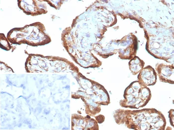 Immunohistochemistry-Paraffin: IMP3 Antibody (IMP3/8985R) [NBP3-23625] - Formalin-fixed, paraffin-embedded human placenta stained with IMP3 Antibody (IMP3/8985R) Inset: PBS instead of primary antibody; secondary only negative control.