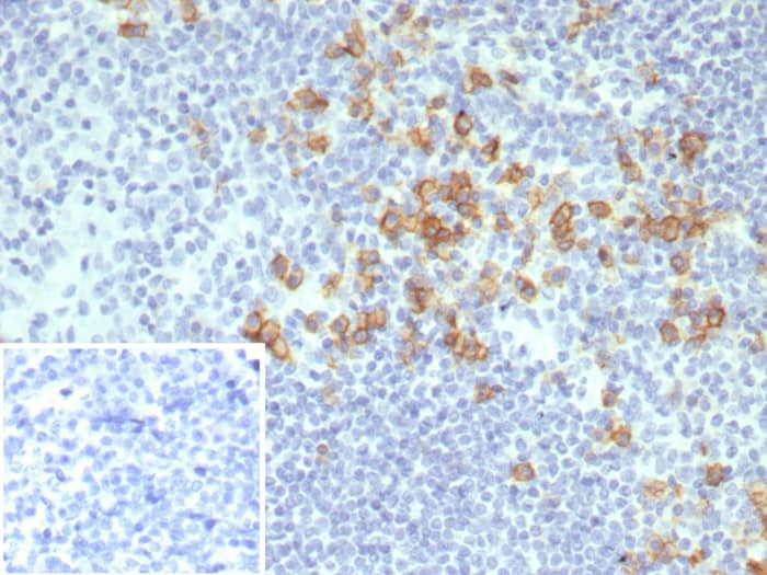 Formalin-fixed, paraffin-embedded human tonsil stained with CD38 antibody (CD38/8075R). Inset: PBS instead of primary antibody; secondary only negative control.