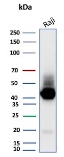 Western Blot Analysis of Raji cell lysate using CD38 Antibody (CD38/8075R).